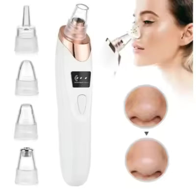 Electric Blackhead Remover Vacuum – Pore Cleanser & Skin Revitalizer